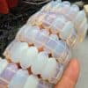 20 Mm Opal Dogal Tas Bileklik 3